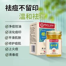 XC香港大药房 草本祛痘膏*50g