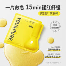 YOU&PURE 羽素 安修祛痘面膜补水保湿面膜舒缓修护痘肌净痘祛痘大灯泡礼物