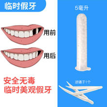 衡铭 补牙神器自己补牙齿洞膏烂蛀假牙缝填充剂树脂材料临时缺牙烤瓷牙