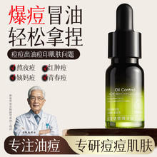 柳眉芙蓉 祛痘精华液去痘印控油去痘收缩毛孔男女学生青春痘