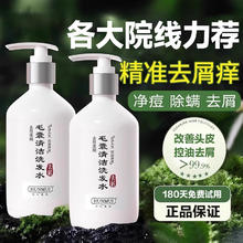 others 其他 毛囊洗发水头皮深层清洁除螨去屑止痒控油蓬松