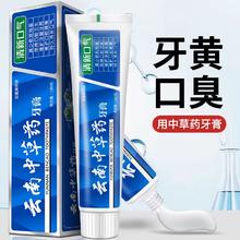 云南白药 牙膏 1支