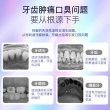 neward 声波可视洗牙器洁牙仪冲牙结石去除神器牙齿清洁污垢除牙垢