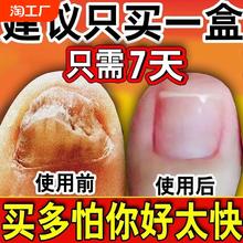 阿莫罗芬搽剂灰指甲专用正品旗舰店修复脱甲膏真菌感染抑菌液灰甲