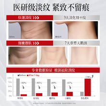 倾龄 颈霜颈纹霜去颈纹提拉紧致润泽美白保湿淡化神器美颈霜脖子祛颈纹