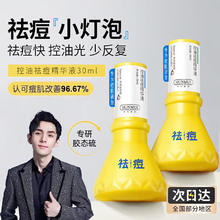 HUNMUI 韩伦美羽 胶态硫控油祛痘精华液淡化痘印修护痘坑痘疤大灯泡祛痘精华 1瓶 30ml 控油祛痘精华液