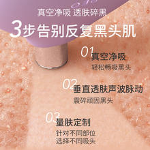 88VIP会员：FOREO KIWI derma黑头吸尘器 院线级无痛去黑头