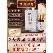 脂肪粒去除神器汗管粒眼角眼周器去眼部脂肪粒眼霜专用精华液男女