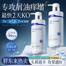 维特丝 Vetes 二硫化硒洗发水去屑止痒控油持久蓬松洗头膏男女士除螨净痘留香 95%客户的选择