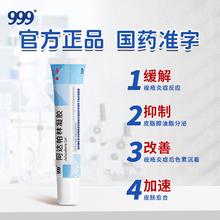 祛痘闭口去粉刺！999 阿达帕林凝胶第三代维a酸乳膏 21g￥19.9