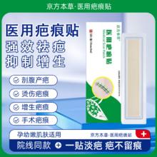 医用疤痕贴